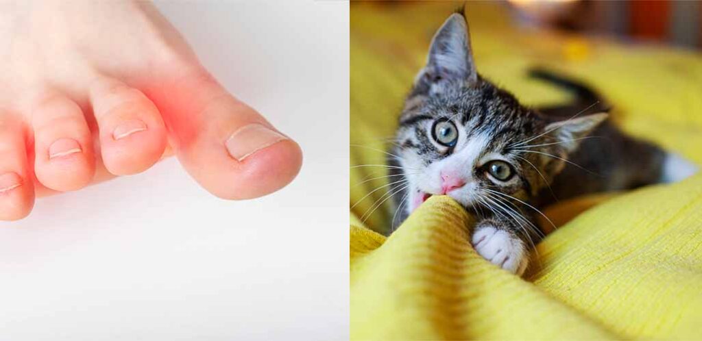 Why Does My Cat Bite My Toes why-does-my-cat-bite-my-toes