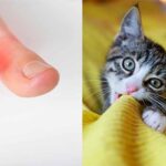 why does my cat bite my toes
